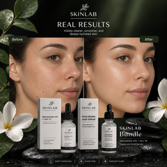 SKINLAB Ultimate Glow Bundle | Hyaluronic Acid + Niacinamide Serum