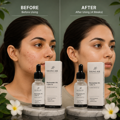 SKINLAB Niacinamide 10% + Zinc 1% Serum