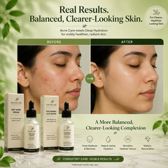 Acne Care & Hydration Duo