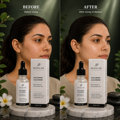 SKINLAB Hyaluronic Acid Serum